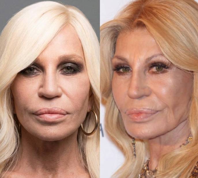 Comparação de fotos de Donatella Versace jovem e atual, mostrando a evolução visual da estilista italiana ao longo das décadas
